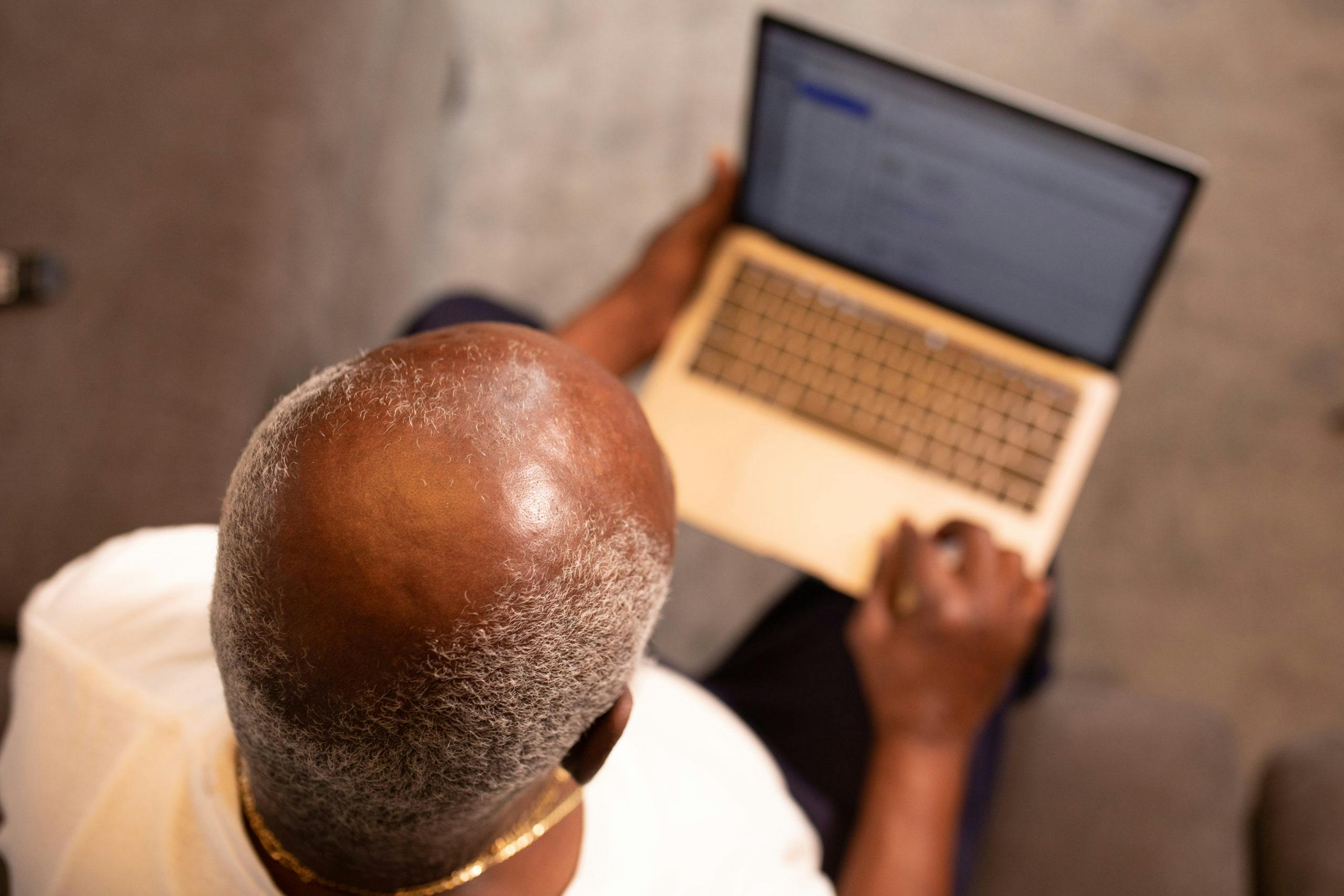 Pattern baldness incidence rate runs into millions across the world, according to the Journal of the American Academy of Dermatology. Though associated with ageing, the rise in early onset among an increasing number of young adults is a worrying trend.