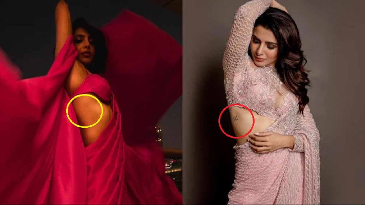 Samantha Ruth Prabhu Remove Tattoo