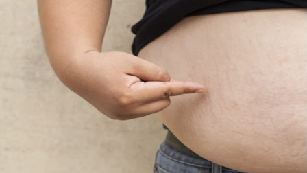 Obesity is a greater risk factor for heart problem than pregnancy problems