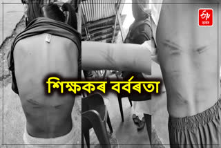 arunachal students beaten by teacher