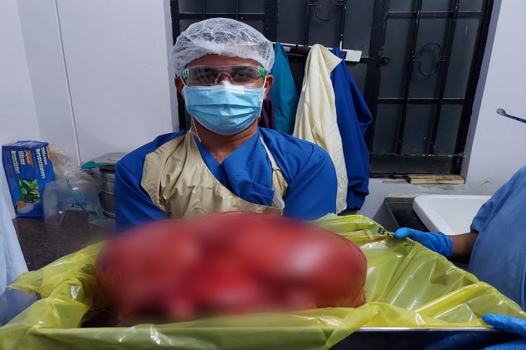 fibroid removed from uterus