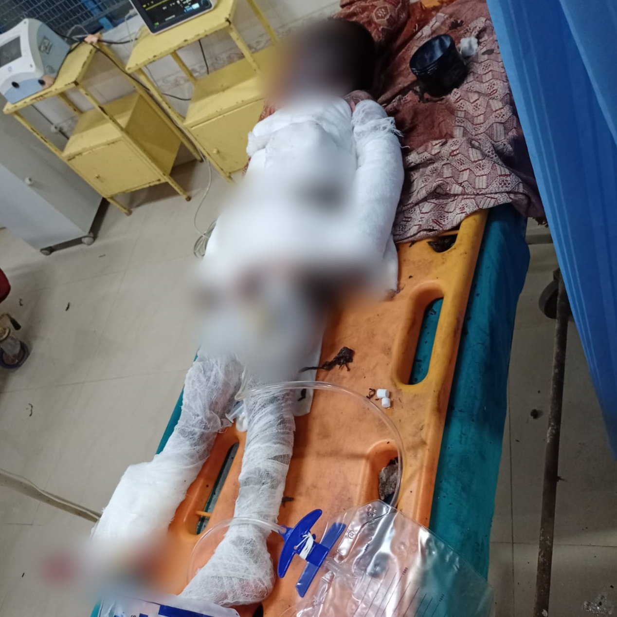 Father and son burnt alive, Father and son burnt alive in Mandya, Mandya crime news, Mandya crime latest news, Mandya fire news, ತಂದೆ ಮತ್ತು ಮಗ ಸಜೀವ ದಹನ, ಮಂಡ್ಯದಲ್ಲಿ ತಂದೆ ಮತ್ತು ಮಗ ಸಜೀವ ದಹನ, ಮಂಡ್ಯ ಅಪರಾಧ ಸುದ್ದಿ, ಮಂಡ್ಯ ಬೆಂಕಿ ಸುದ್ದಿ,