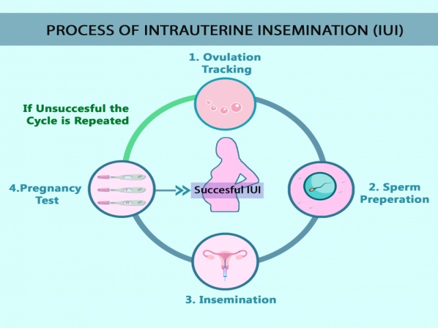 pregnancy artificially