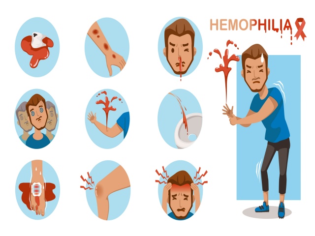 Haemophilia, COVID-19, Bleeding Disorder