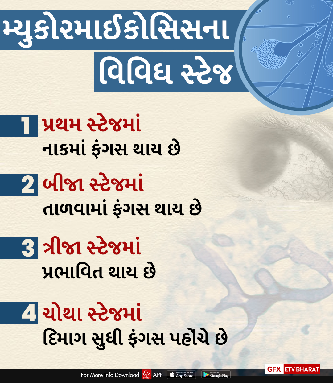 મ્યુકોરમાઈકોસિસના વિવિધ સ્ટેજ