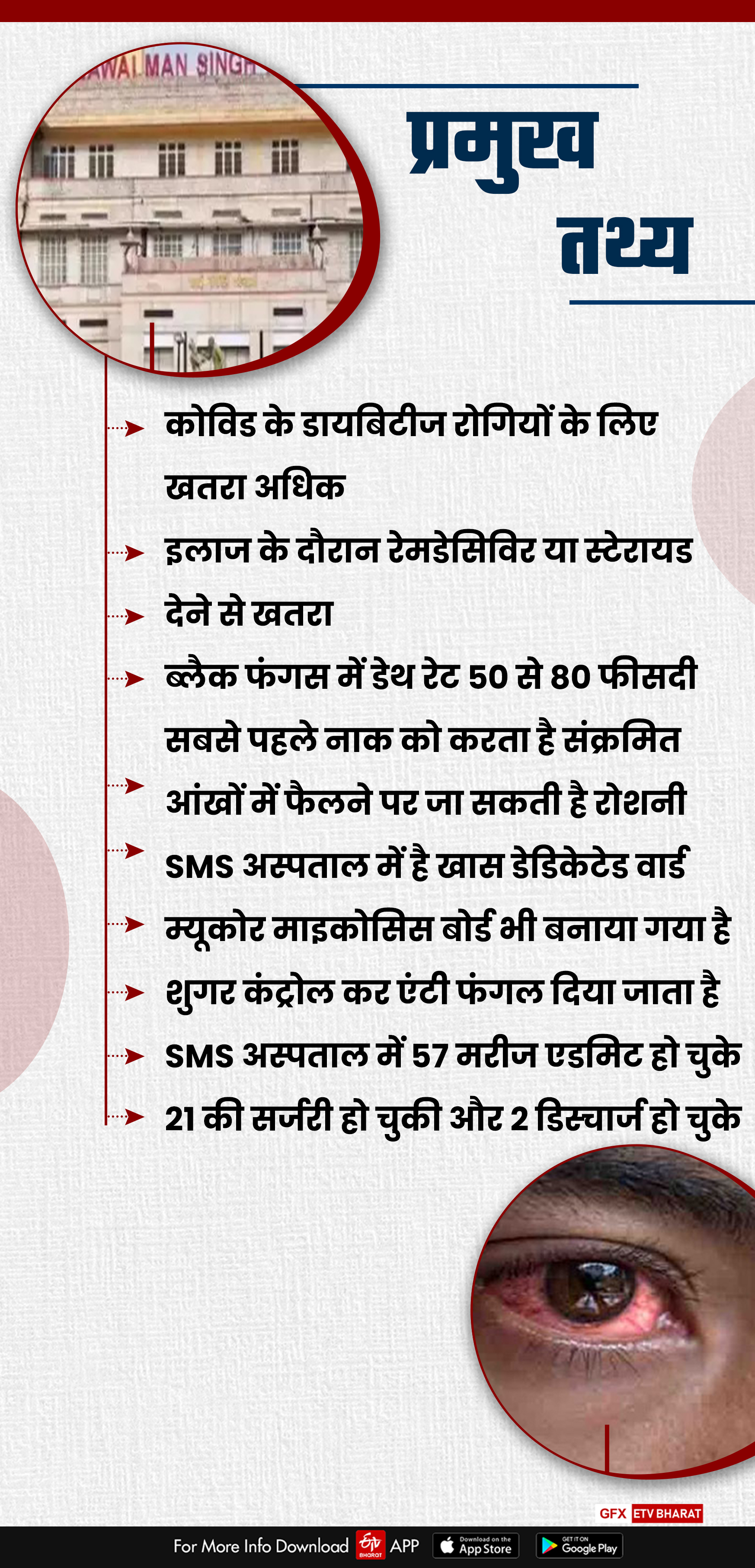 कोविड मरीजों में ब्लैक फंगस, एसएमएस अस्पताल में तैयारी , Preparation in SMS Hospital,  ETV Bharat conversation with SMS hospital doctor, Jaipur news