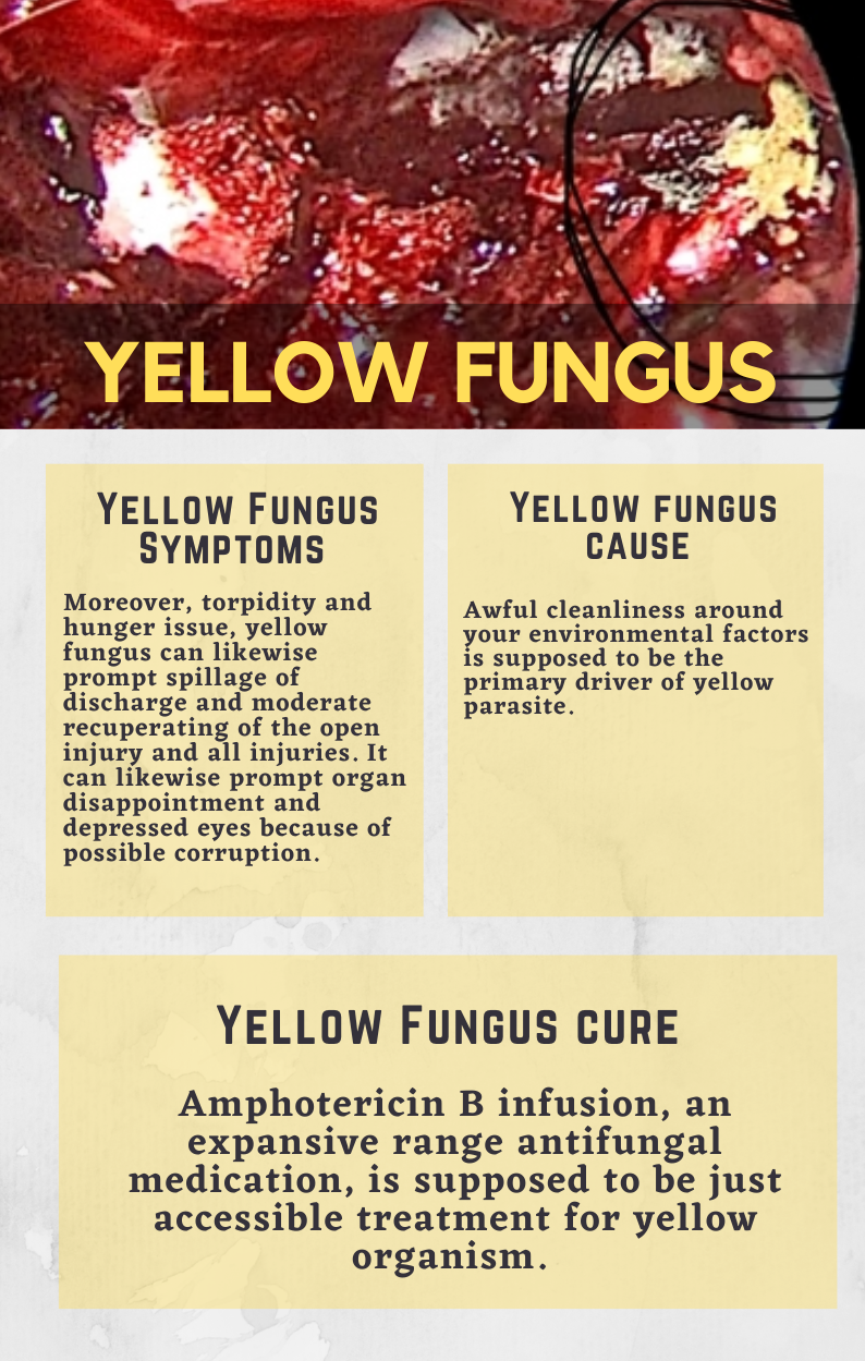 After b&w, now Yellow Fungus reported in India