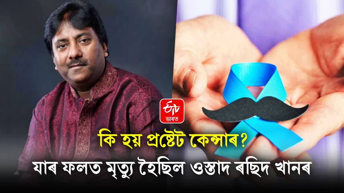 What is prostate cancer, due to which Ustad Rashid Khan died, know its symptoms