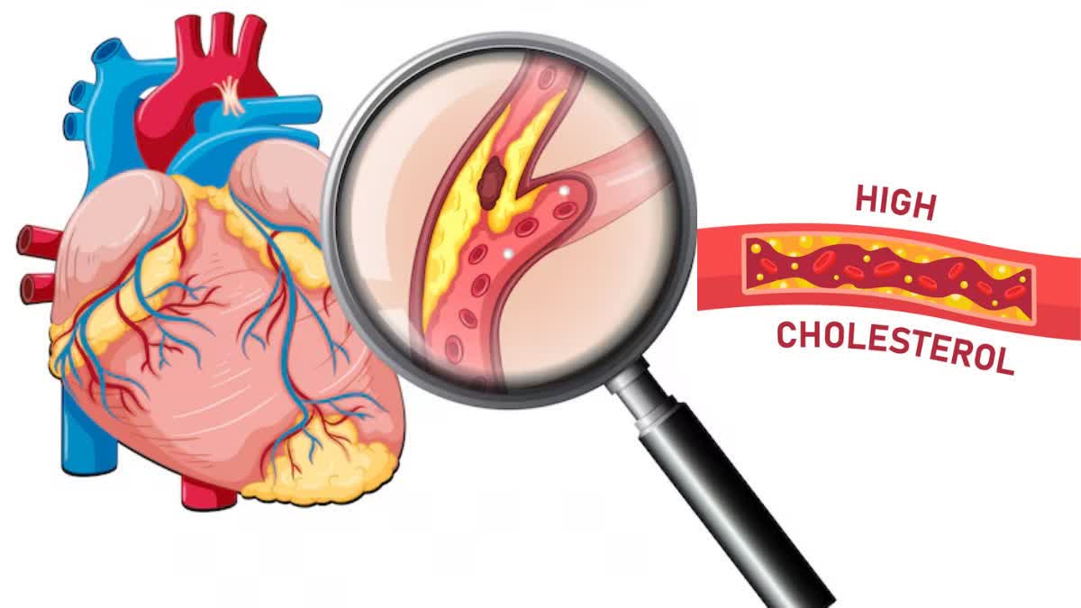 HOW TO CONTROL HIGH CHOLESTEROL