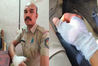 Constable Was Injured In Attack  Police Constable Attacked In Idukki  ഇടുക്കി പൊലീസ് ഉദ്യോഗസ്ഥന് പരിക്ക്  മാങ്കുളത്ത് പ്രതി കസ്‌റ്റഡിയിൽ