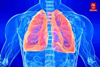 Lung cancer