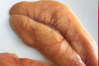 Health Benefits Of Fish Egg Or Caviar How it is good for heart and blood pressure