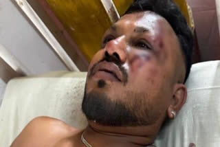 விமான விபத்தில் உயிர் பிழைத்த விஸ்வாஷ்குமார் ரமேஷ்