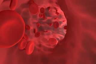 Hemoglobin Deficiency Problem