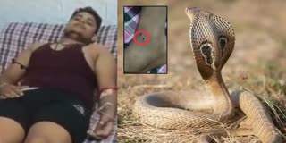 Uttar Pradesh Man Gets Bitten By Snake 6 Times in 34 days watch video