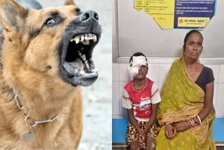 Stray Dog Attack In Begusarai