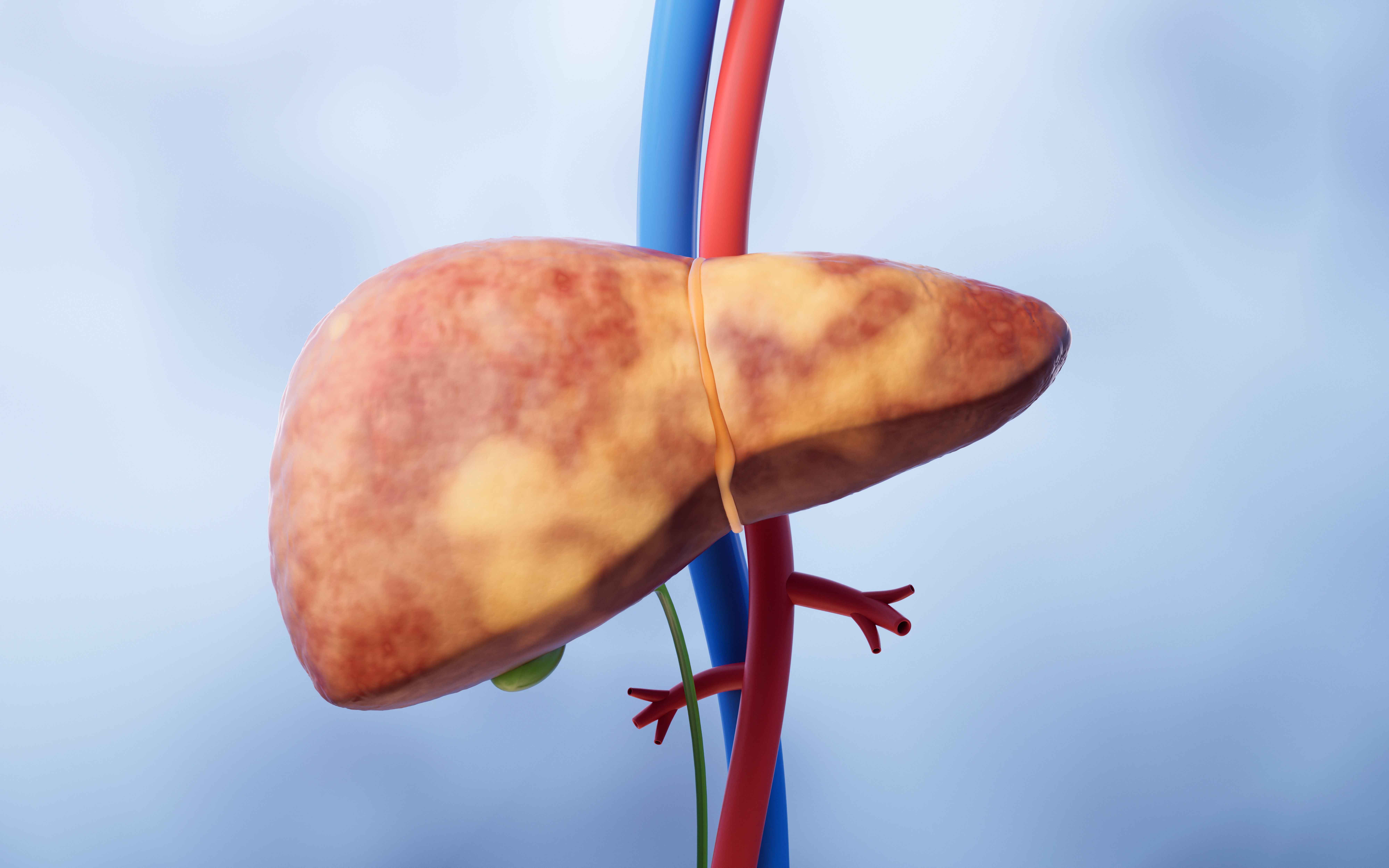 LIVER CANCER SENSOR DETECT CANCER HEALTH ISSUES DETECT LIVER CANCER