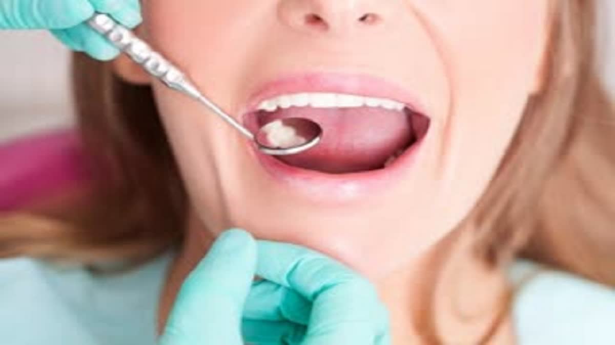 Gingivitis Problem In India