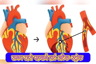 Heart Attack Stroke Symptoms after covid19 infection and covid19 side effects