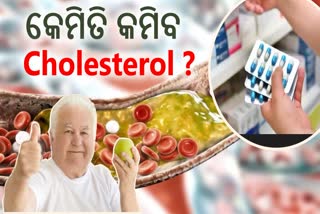 Control Cholesterol Without Drugs