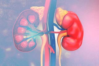 Artificial kidneys