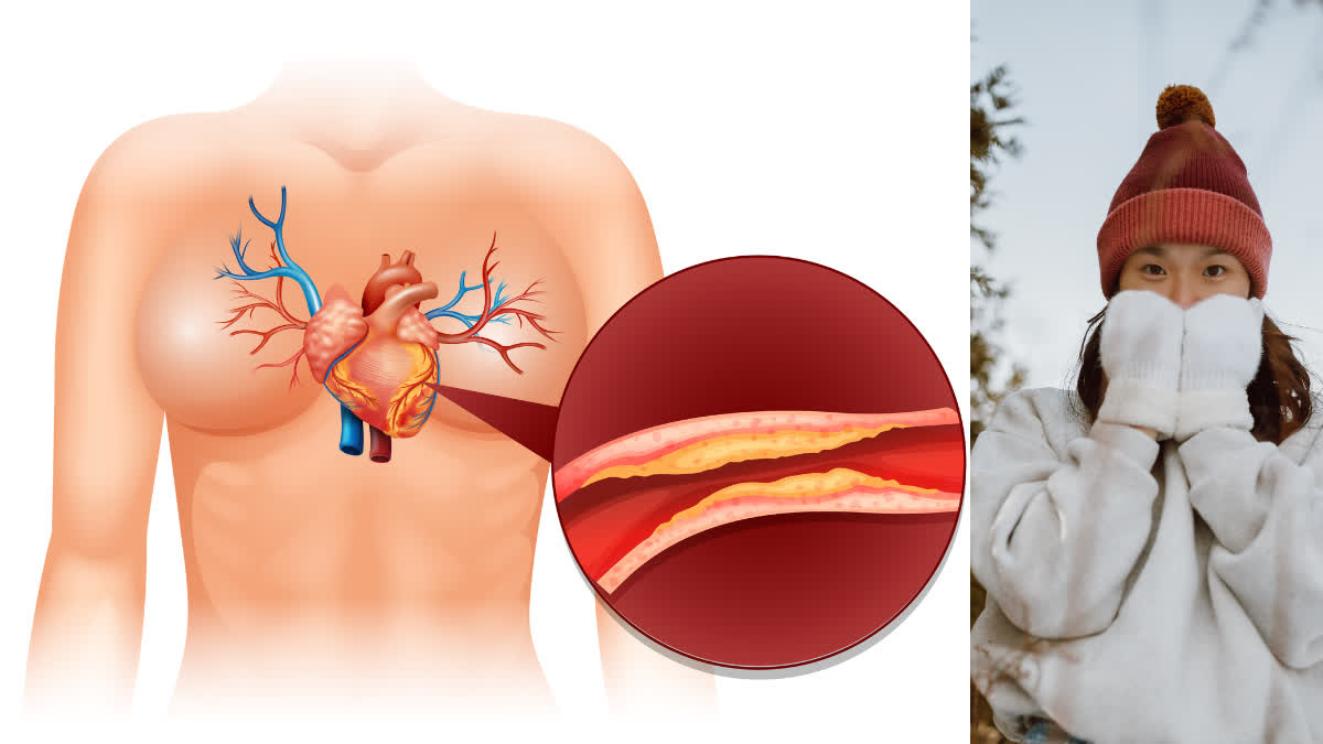 Bad cholesterol increases in cold weather?