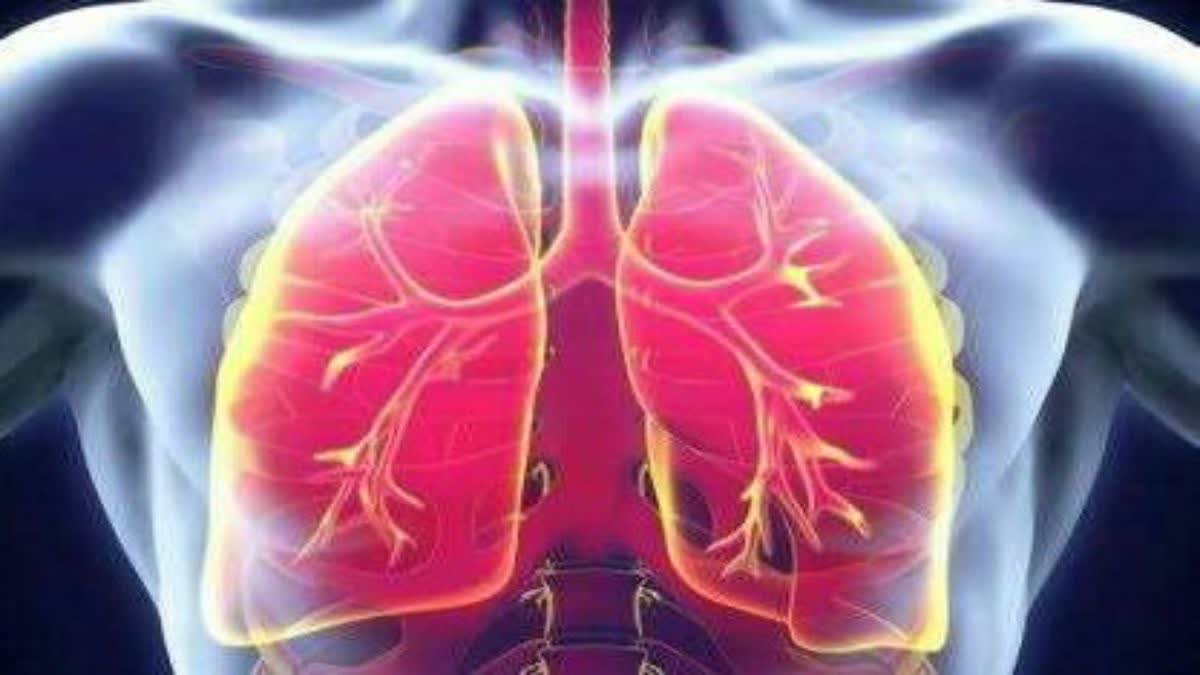 Etv Bharatworld tuberculosis day 11 thousand 769 patients died due to TB in Mumbai in 5 years