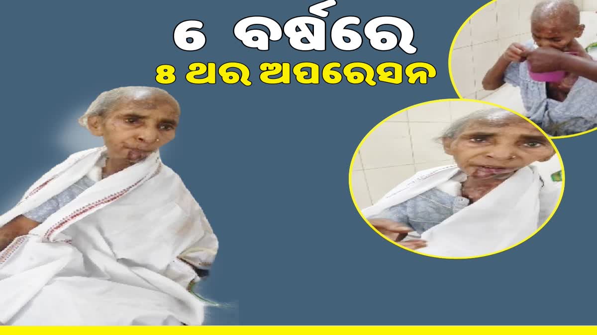 80 ବର୍ଷୀୟ ବୃଦ୍ଧାଙ୍କ 8 ଥର କ୍ୟାନ୍ସର ଅପରେସନ