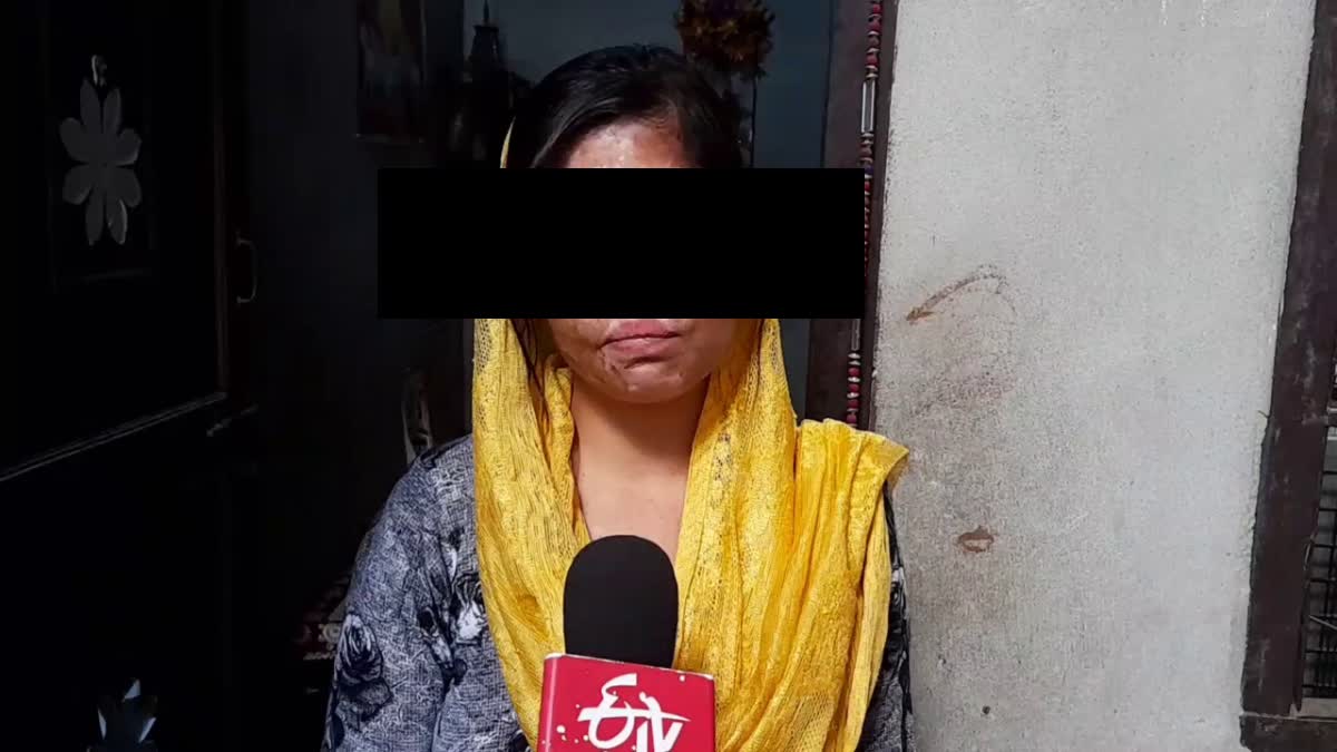 acid attack victim woman in Panipat