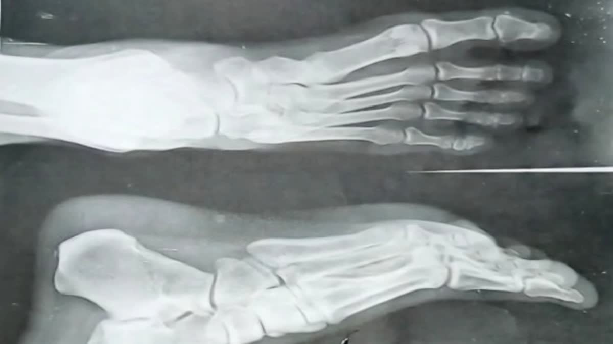 gwalior district hospital xray on paper