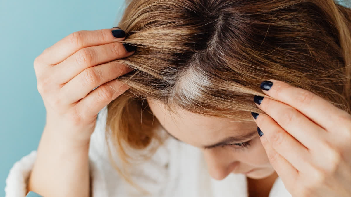 American scientists have discovered the cause of hair turning gray