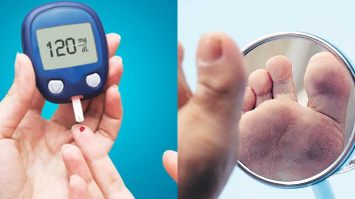 how to prevent diabetic foot