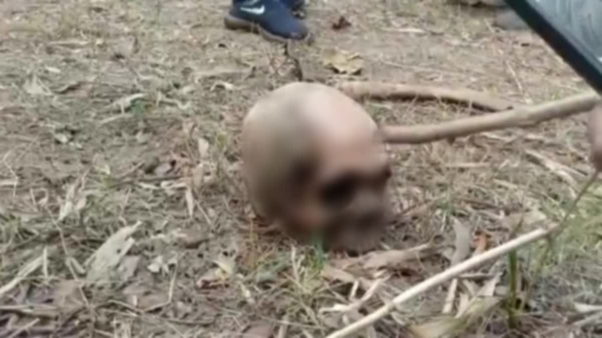 Recover of Human Skull