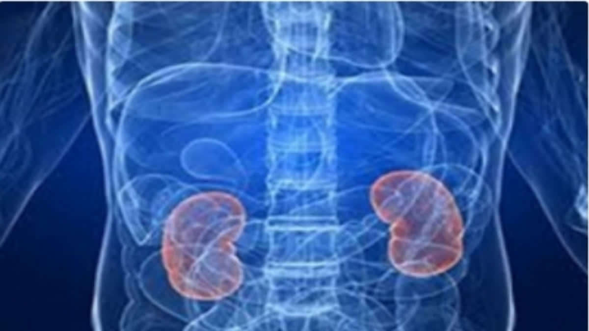 If kidney stone is not treated at the right time, it can lead to cancer