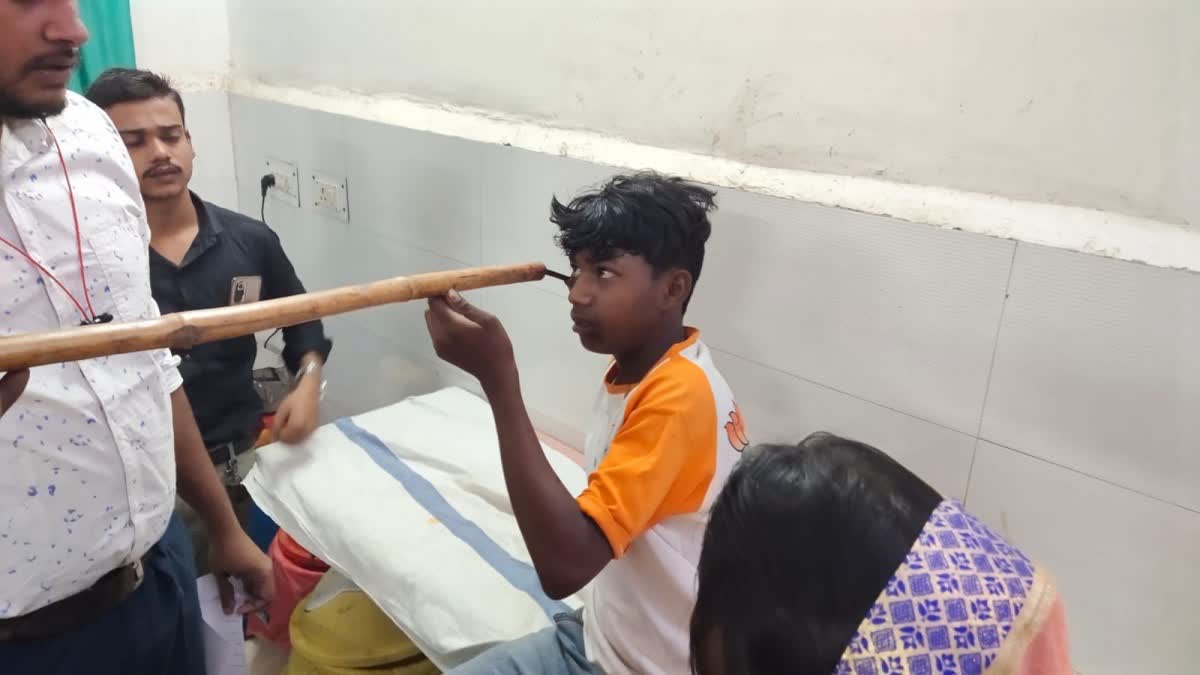 iron rod entered in child eye in shahdol