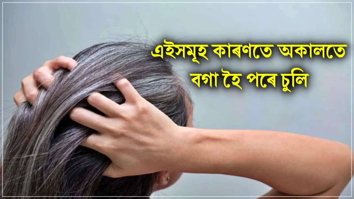 Deficiency of this vitamin also causes hair to turn white quickly, know how the problem will go away