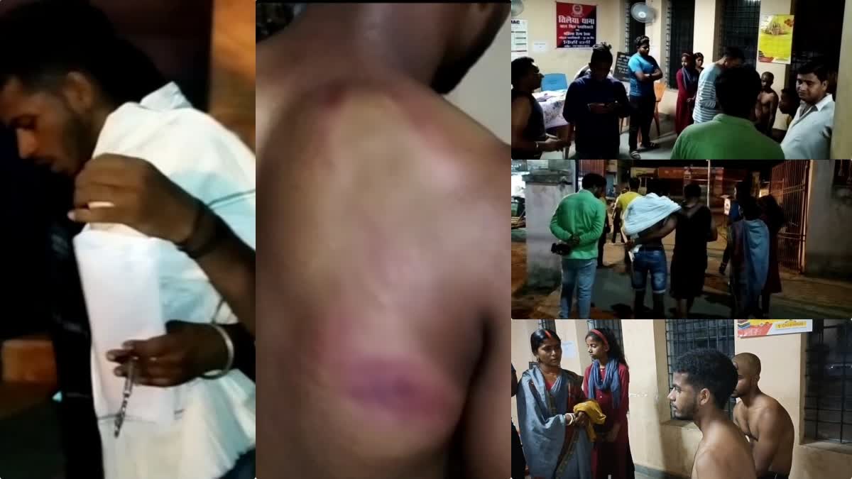 Shopkeeper beat up customers over tomatoes in Koderma