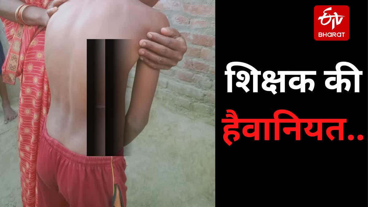 burning student with knife in Bettiah