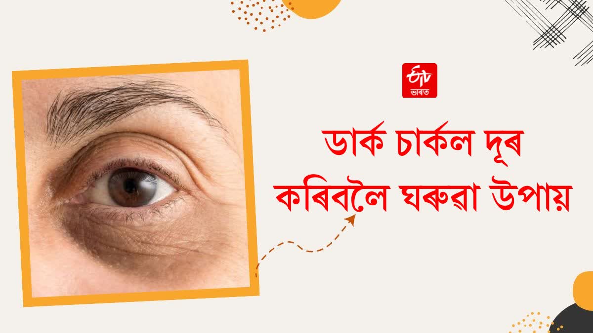 Have dark circles spoiled the beauty of your face? Get rid of these remedies soon