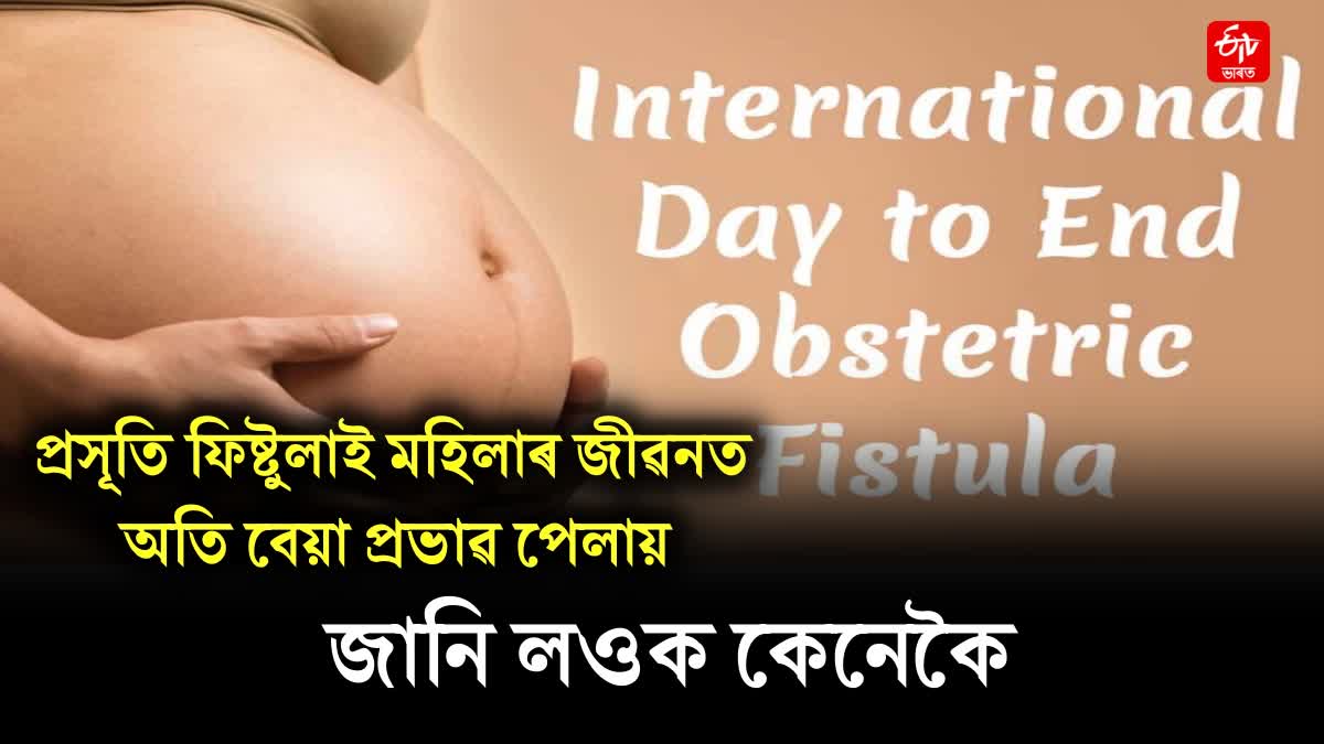 International Day to End Obstetric Fistula observed to raise awareness about Obstetric Fistula