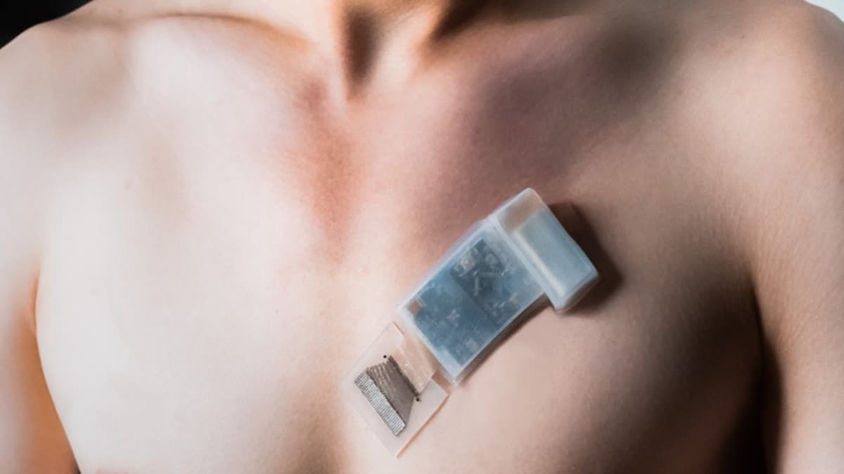 this wearable ultrasound system will manage cardiac function