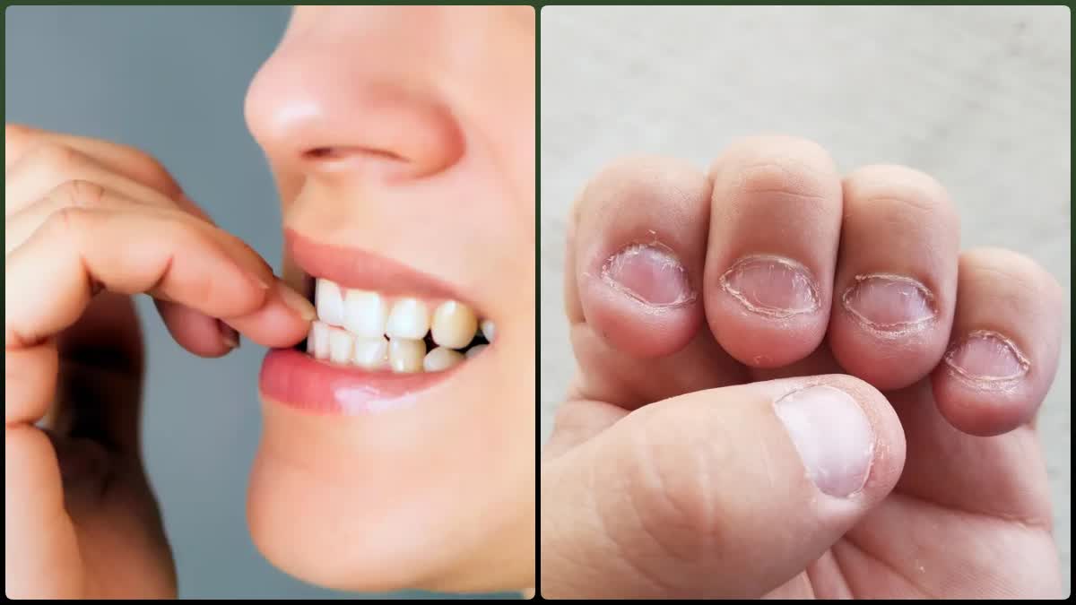 nail biting girl effects｜TikTok Search