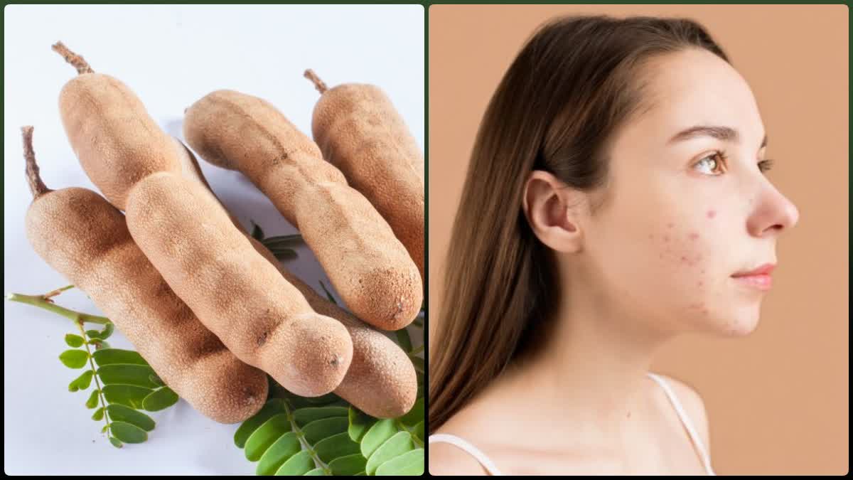 Sweet Tamarind Benefits