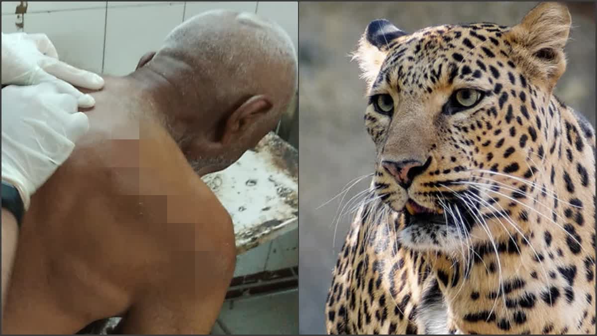 one Injured in Leopard Attacked