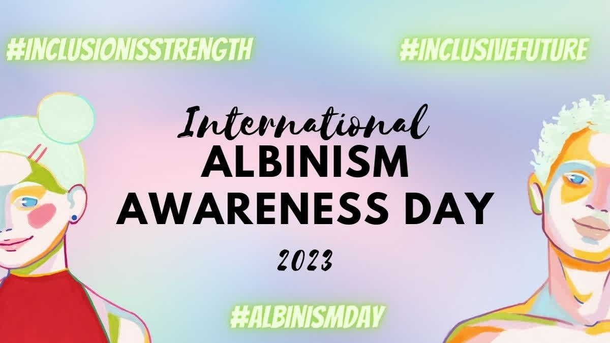 International Albinism Awareness Day 2023: Inclusion Is Strength