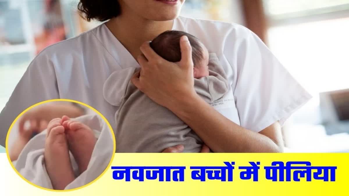 Jaundice in Newborns in Himachal.