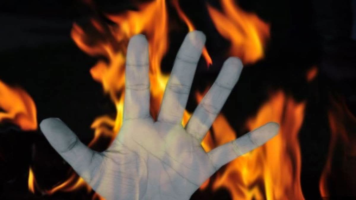 Wife Sets Ablaze Husband