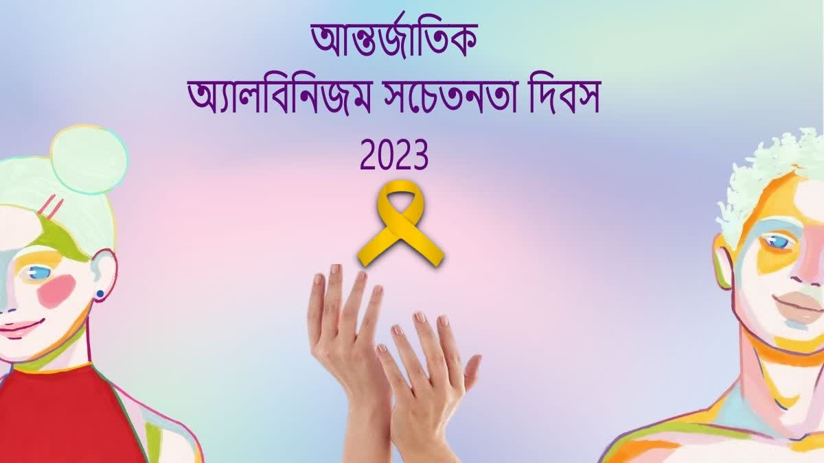 International Albinism Awareness Day 2023