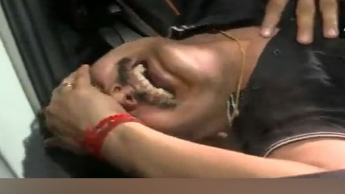 Tamil Nadu Senthil Balaji: ડીએમકેના મંત્રીને EDના દરોડા પછી છાતીમાં દુખાવો