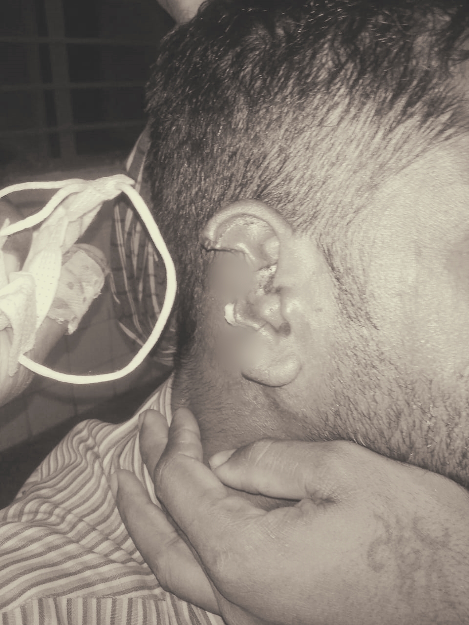 Man who bit his friend's ear arrested
